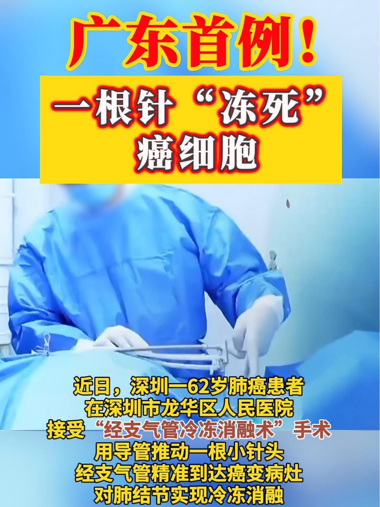 男子確診肺癌醫(yī)生一根針凍死癌細(xì)胞插圖