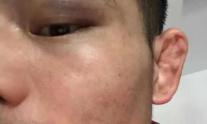 武術散打季軍稱遭群毆，官方回應已和解縮略圖